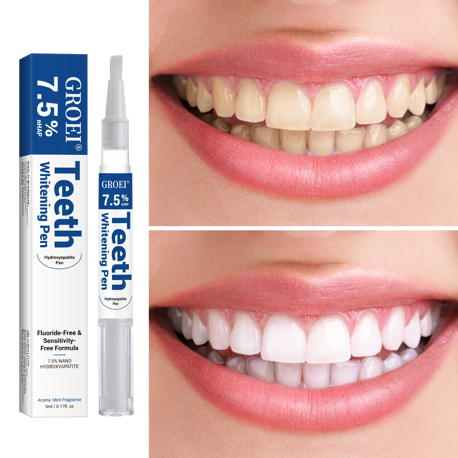 하이드록시아파타이트 치아 미백 펜 눈부신 화이트 얼룩  - Teeth Whitening Gels Used By Dentists 리뷰 및 가격