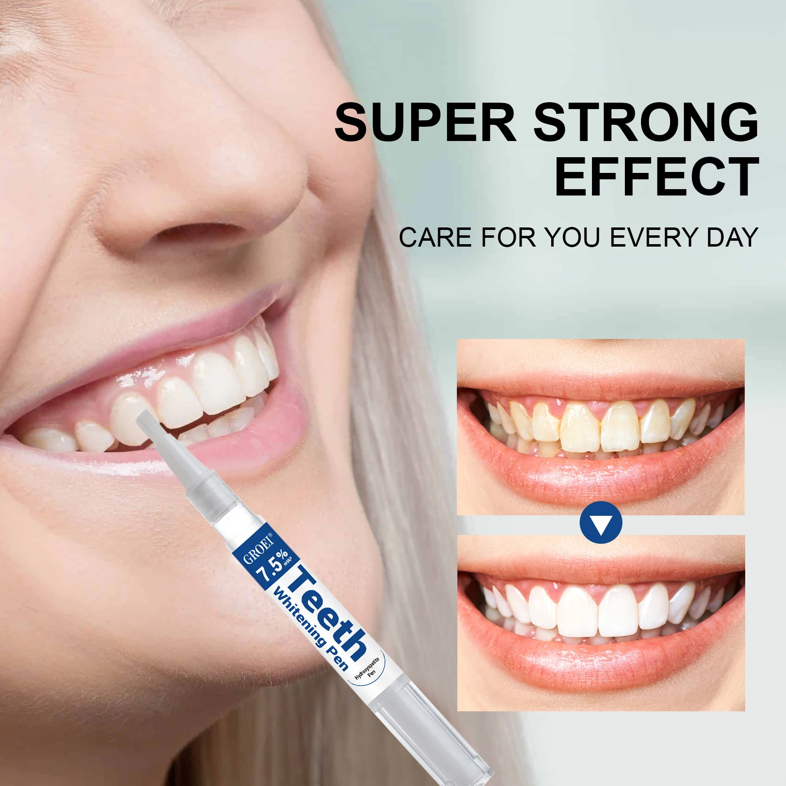 하이드록시아파타이트 치아 미백 펜 눈부신 화이트 얼룩  - Teeth Whitening Gels Used By Dentists 리뷰 및 가격