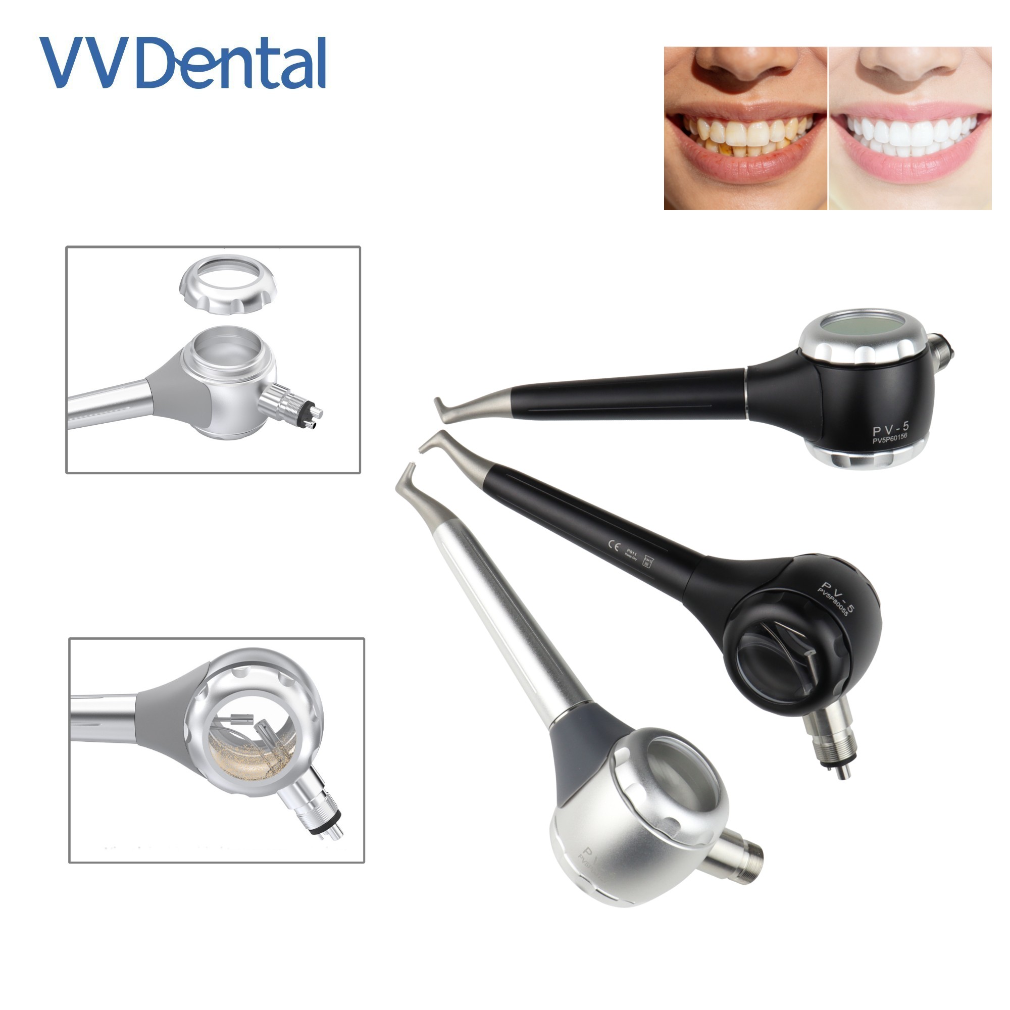 VV 치과용 2/4홀 치아 미백 샌드블라스팅 건 양면  - Teeth Whitening Free 리뷰 및 가격