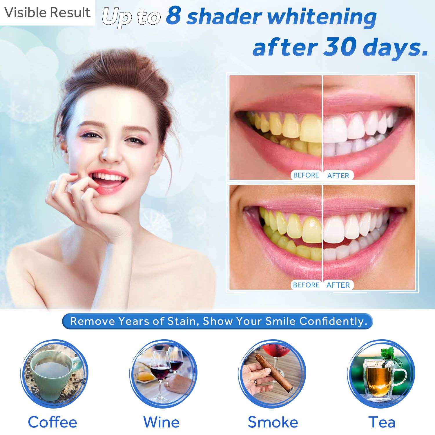 치아 미백 젤 리필 주사기 치아 미백 젤 인비스알라인  - Teeth Whitening Gels Used By Dentists 리뷰 및 가격