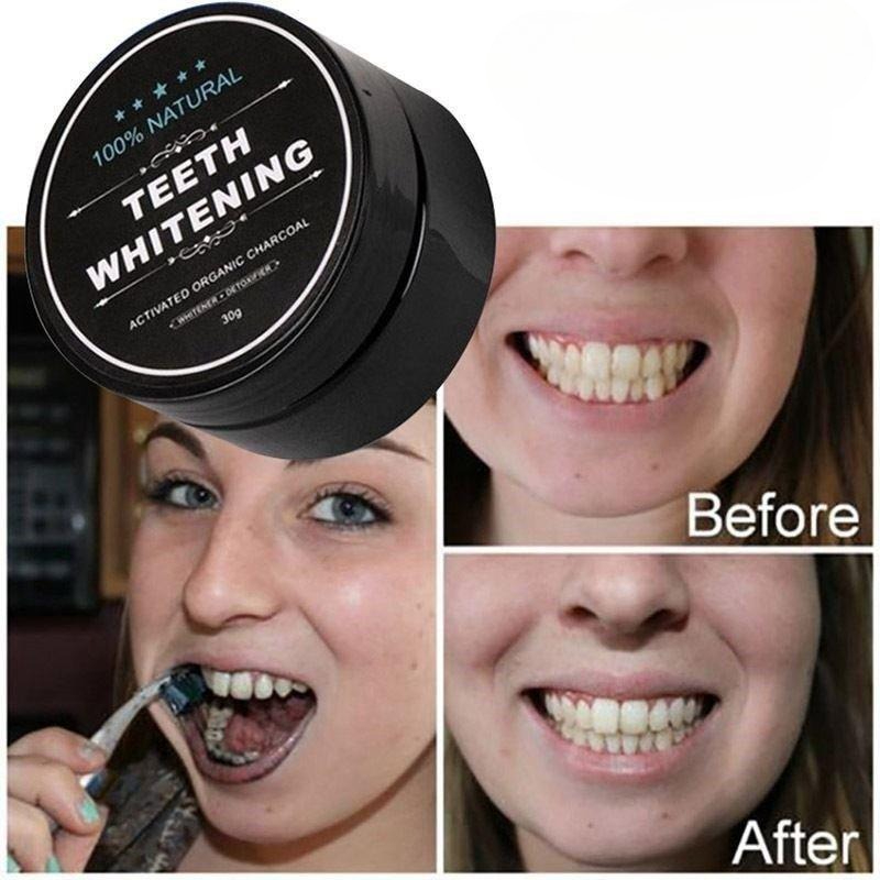 활성탄 치아 미백 파우더 1박스, 숯 치아 클리닝 파우 - Teeth Paint Whitening 리뷰 및 가격