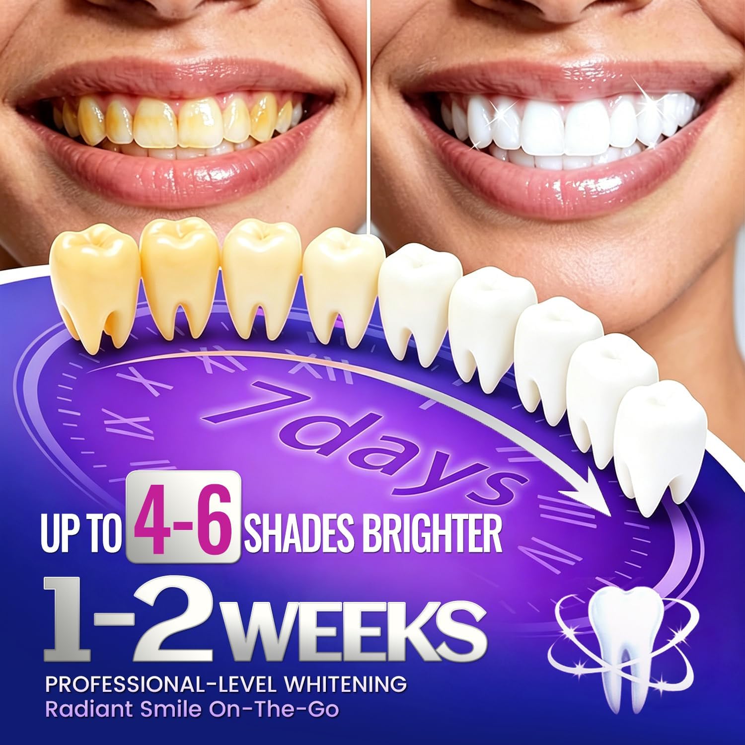 1/7 쌍의 치아 미백 스트립으로 더 하얗게 보이는 미 - Teeth Whitening Street 리뷰 및 가격