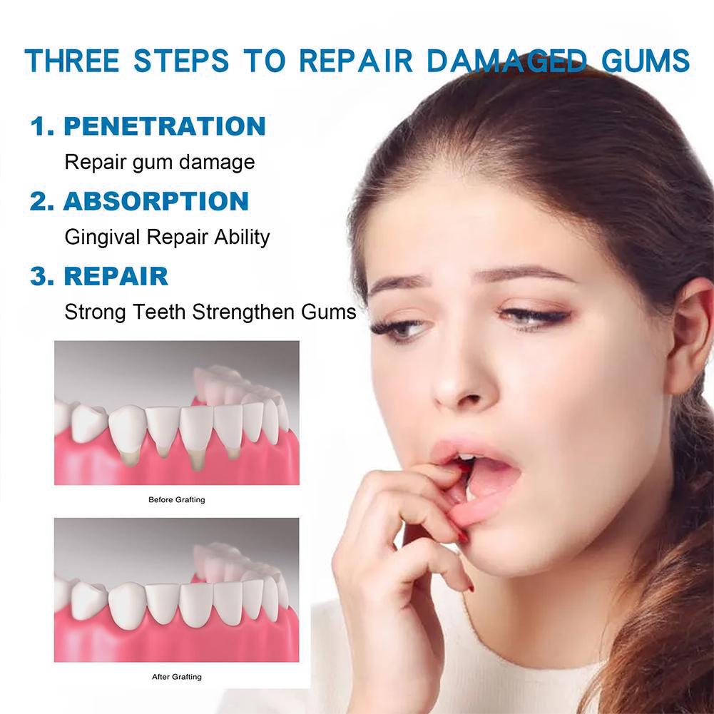 치아 관리 치약 천연 잇몸 진정 치약 천연 치아 미백  - Teeth Whitening Natural 리뷰 및 가격