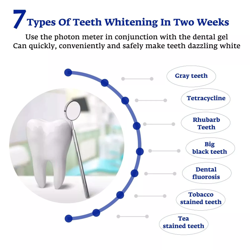 치아 미백 가속기 스마트 LED 블루 라이트 휴대용 U - Teeth Whitening Accelerator 리뷰 및 가격